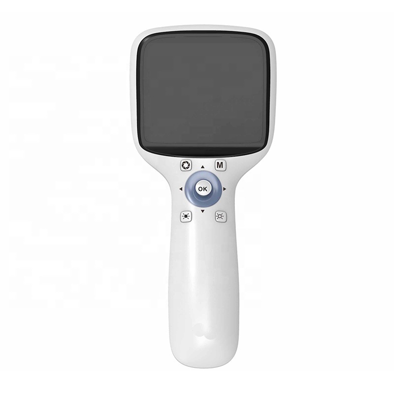 Medical Handheld Fundus Camera Ophthalmic Equipment Ultra Wide Field Eye Portable Hand Held Fundus Camera