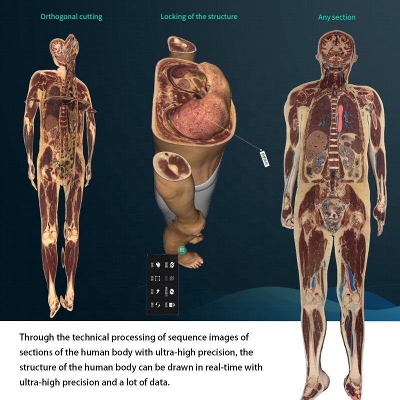 Digital Human Virtual Anatomage Table University Human Virtual 3D Anatomy Dissection Table