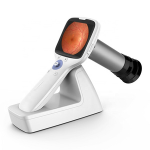 Medical Handheld Fundus Camera Ophthalmic Equipment Ultra Wide Field Eye Portable Hand Held Fundus Camera