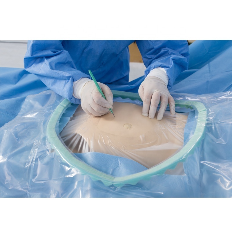 CE/ISO Disposable Cesarean Section (C-section) Surgical Drape Set CS Pack Surgery Sterile Cesarean Surgery Pack