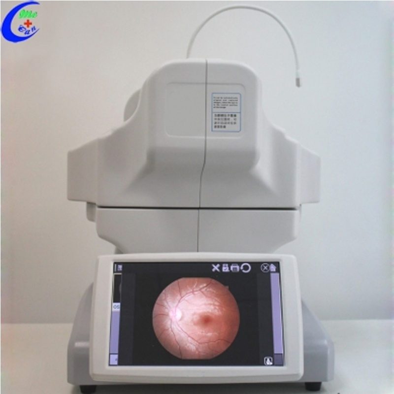 Ophthalmic Auto Digital Non-mydriatic Eye Fundus Camera With FFA