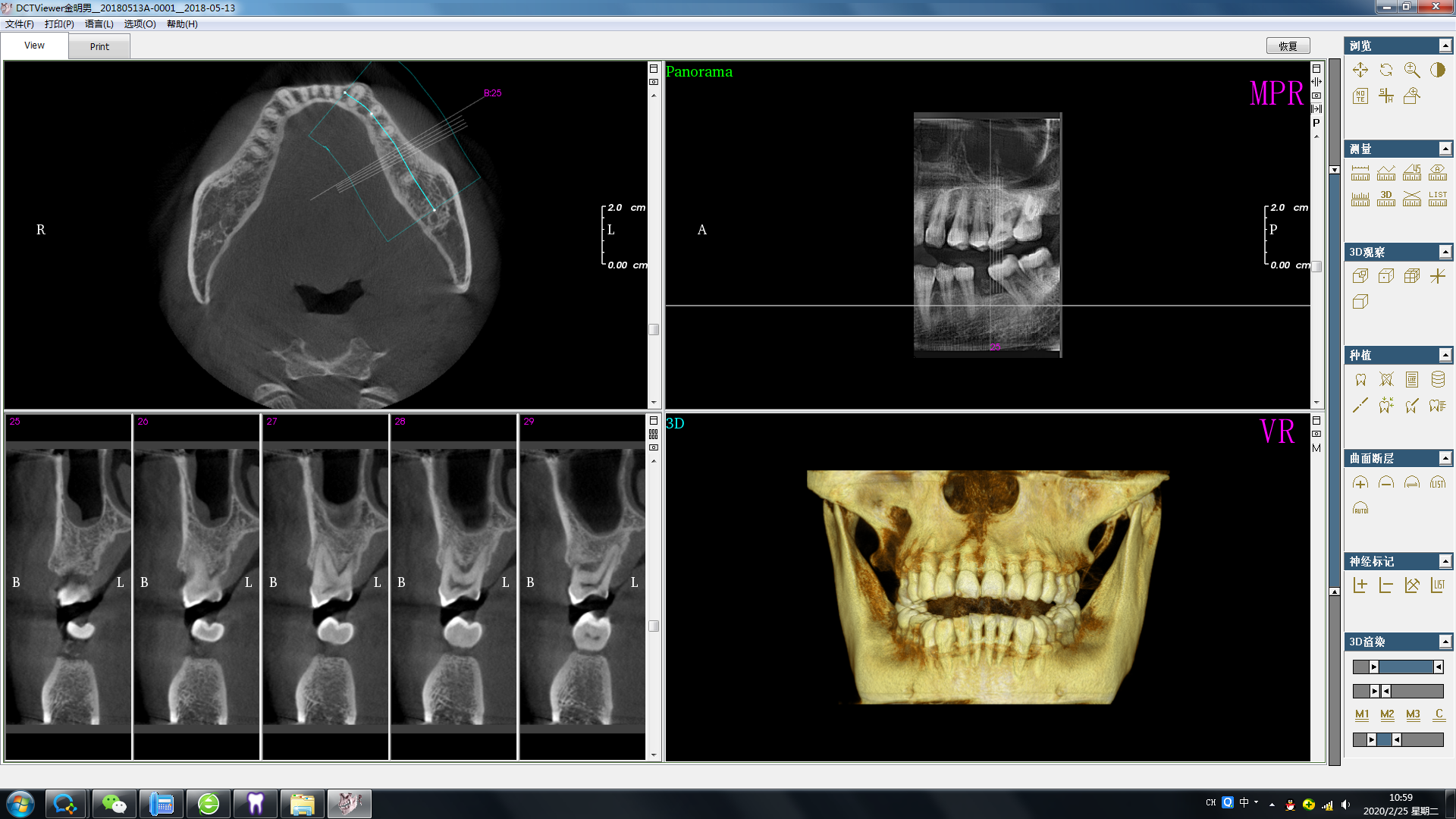 Dental Digital CBCT 3D Panoramic Dental Cephalometric X Ray Machine Digital Dental OPG Panoramic 3D X Ray Tomographic System