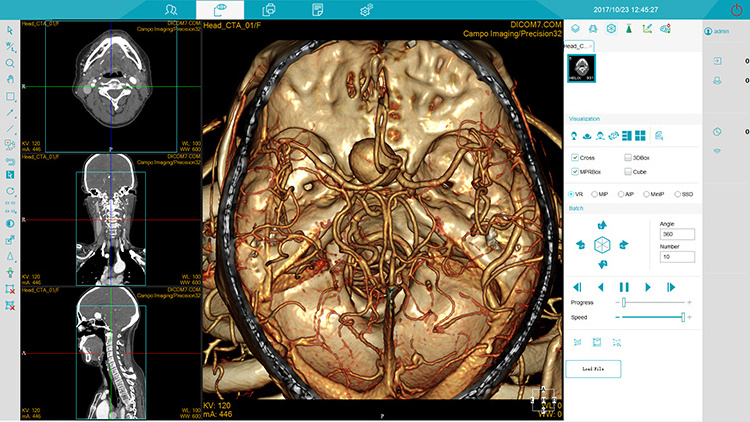 MSL High Energy Ray Medical Equipment 32 64 Slice Spiral CT Scanner with Cardiac CT Scan Machine Price