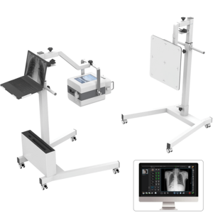 Medical Radiology Diagnostic Equipment 5Kw/8Kw High Frequency Dr X Ray System Medical Portable Digital X-ray Machine