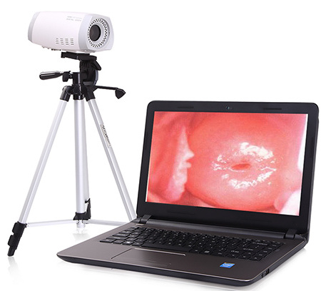 Digital Colposcope Device HD Video  Vaginal Colposcope Camera For Gynecology