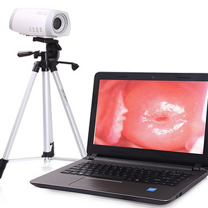 Digital Colposcope Device HD Video  Vaginal Colposcope Camera For Gynecology