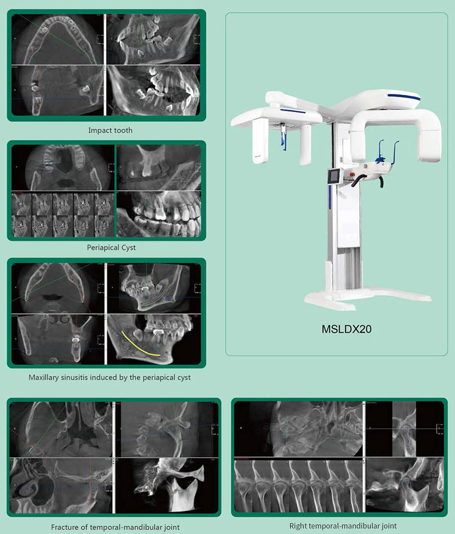 Dental Digital CBCT 3D Panoramic Dental Cephalometric X Ray Machine Digital Dental OPG Panoramic 3D X Ray Tomographic System