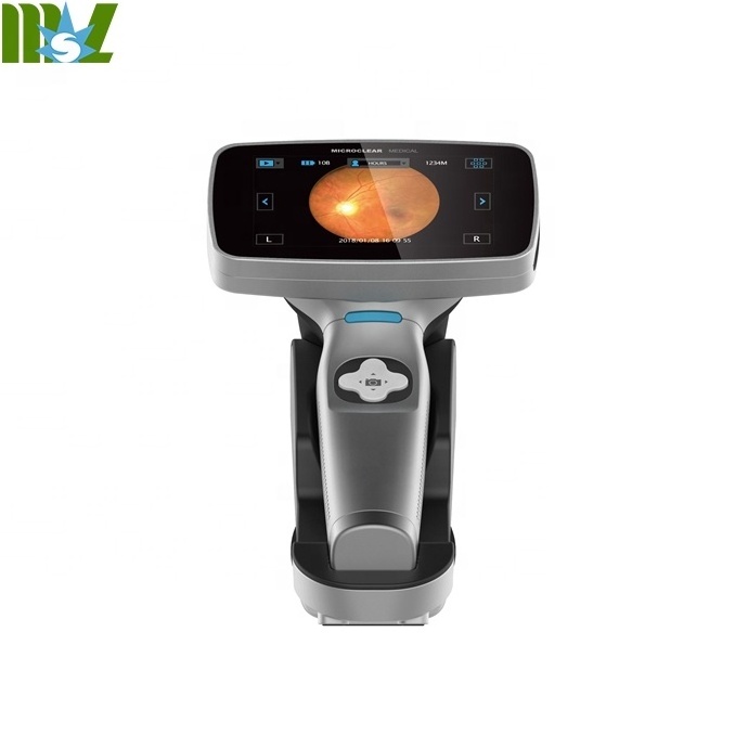 Digital Eye fundus camera, Portable fundus camera with touch screen