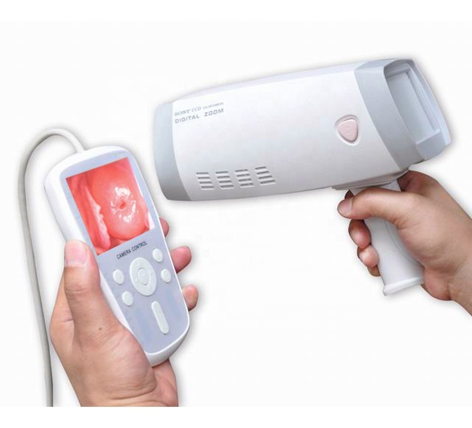 Portable Handheld Video Colposcope / full hd camera for vagina colposcope   (MSLCE04 )