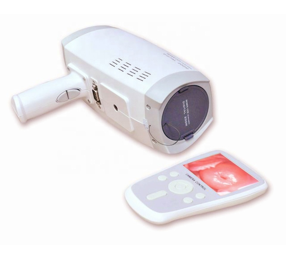 Portable Handheld Video Colposcope / full hd camera for vagina colposcope   (MSLCE04 )