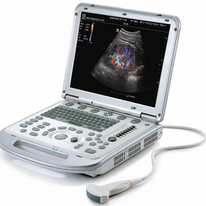 Portable Mindray doppler vascular ultrasound equipment / mindray M7 factory price 4D 3D