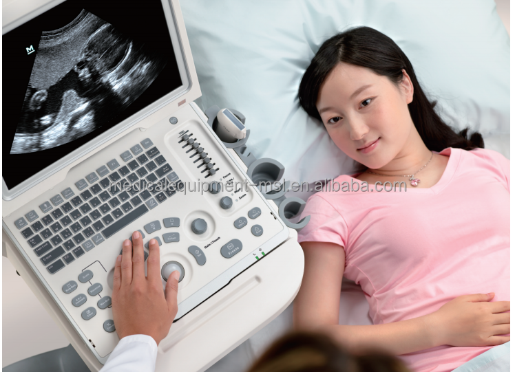 More competitable than mindray M7 M9 ultrasound machine color doppler Mindray Z6