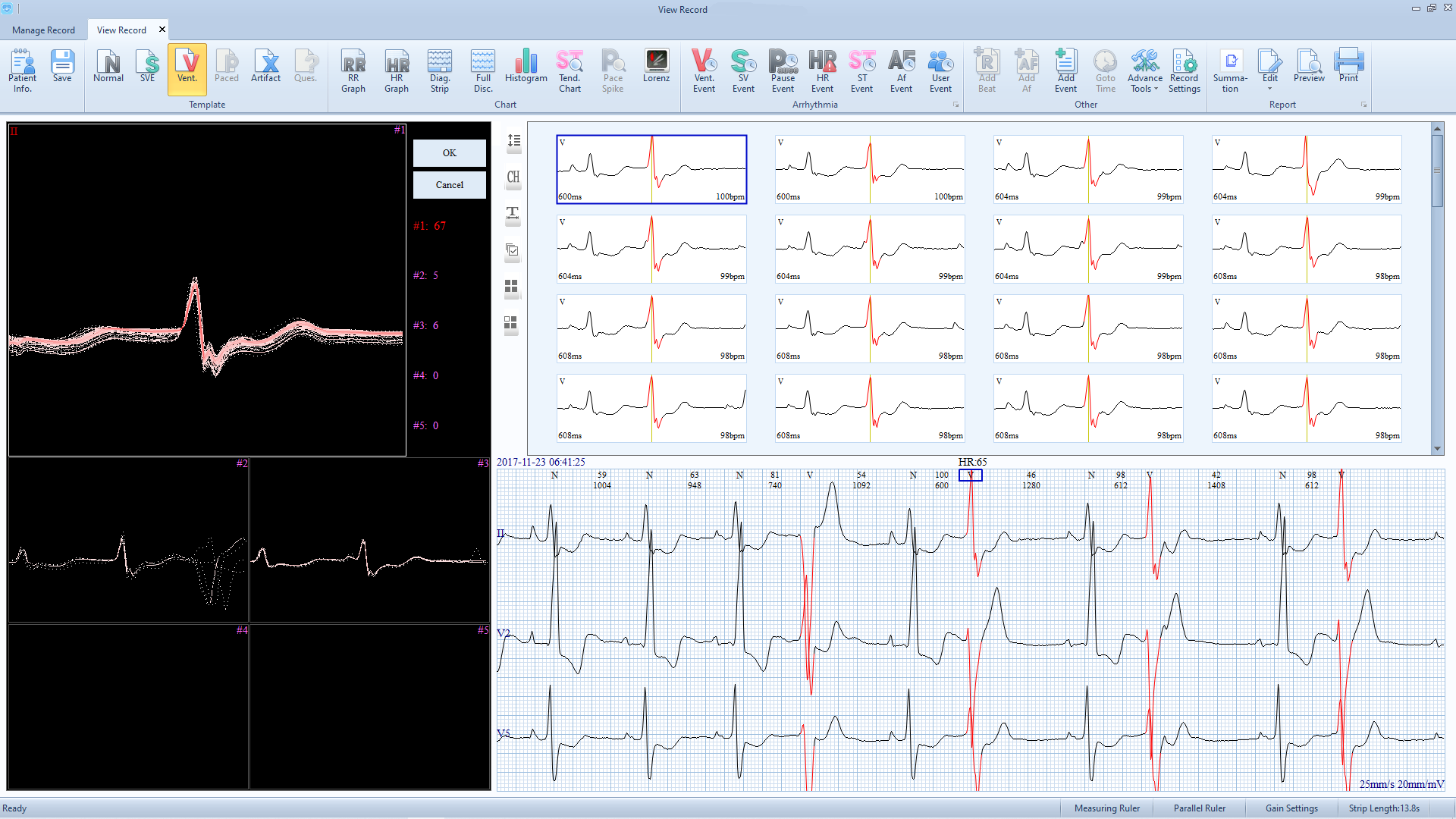 EDAN SE-2012 ECG 3 Channel 12 channel Holter Up to 8 days cable heart rate monitor