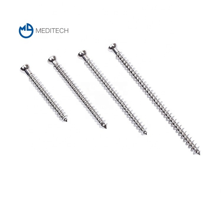 Made in China 3.5 cortical screws orthopedic surgical implant stainless steel distal fibula trauma fracture bone plate