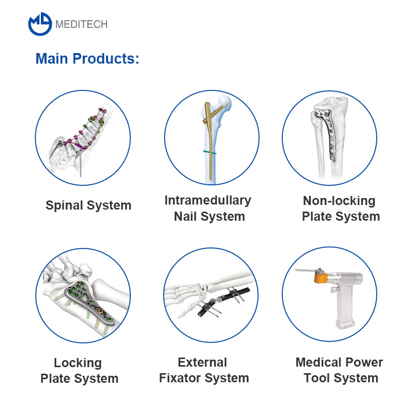 Antirotation Titanium Gamma Proximal Femoral Nail PFNA Orthopedic Implant Set, Clavo Medico Clou Pfn Tibia Intramedullary Nail//