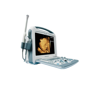 S8i Color Portable Ultrasound Scanner with Multi frequency convex probe with CE ISO