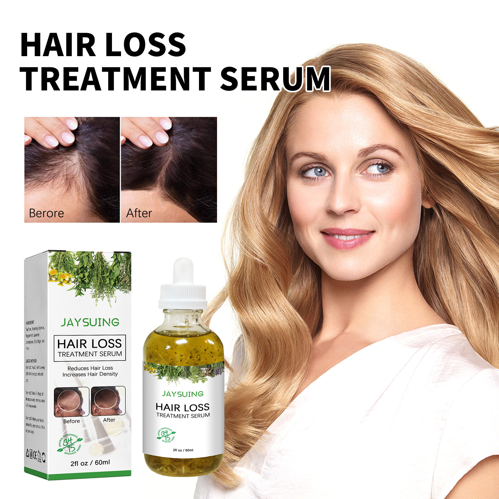 Scalp dense hair oil essence hair growth massage scalp nourishing oil strong and tough dense hair