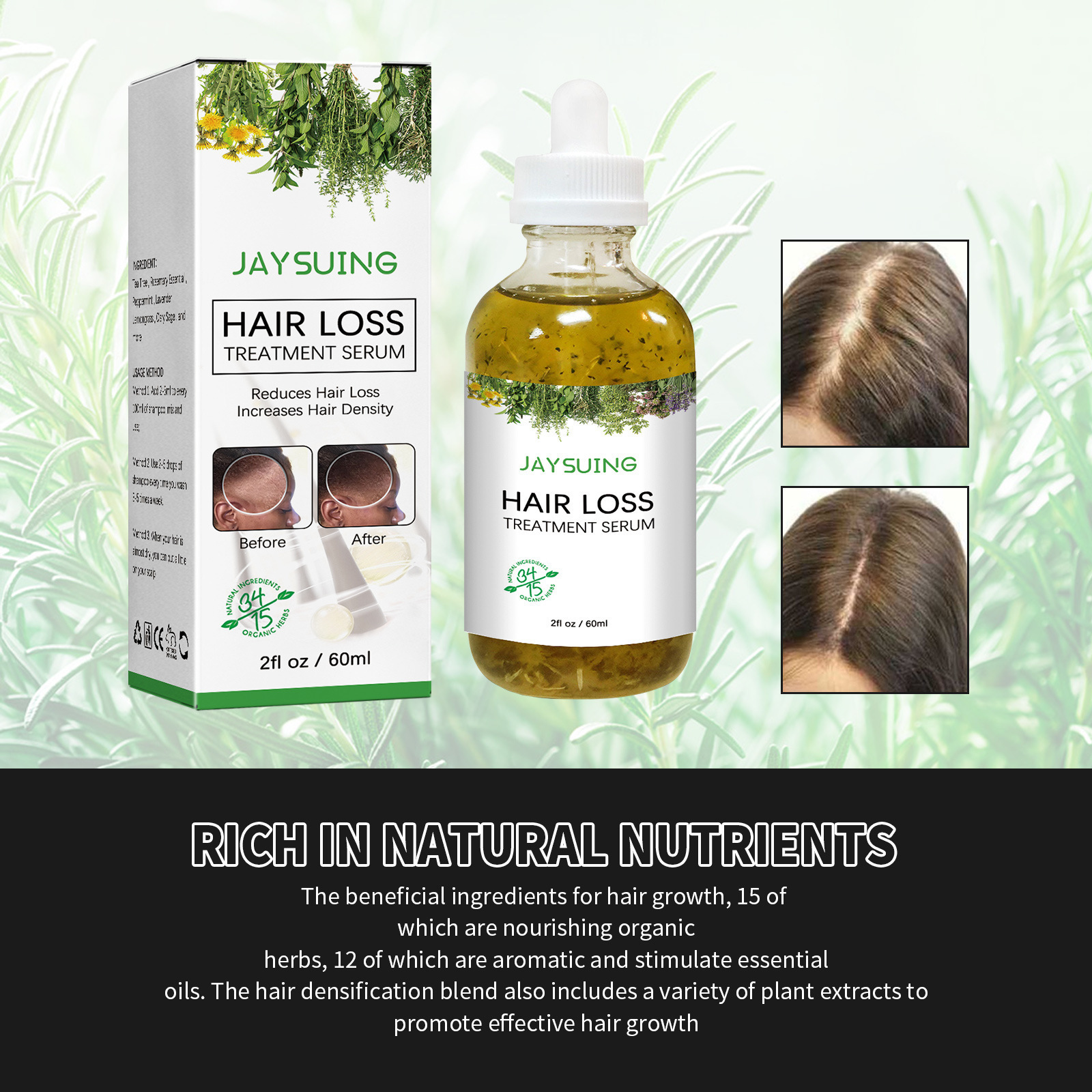 Scalp dense hair oil essence hair growth massage scalp nourishing oil strong and tough dense hair