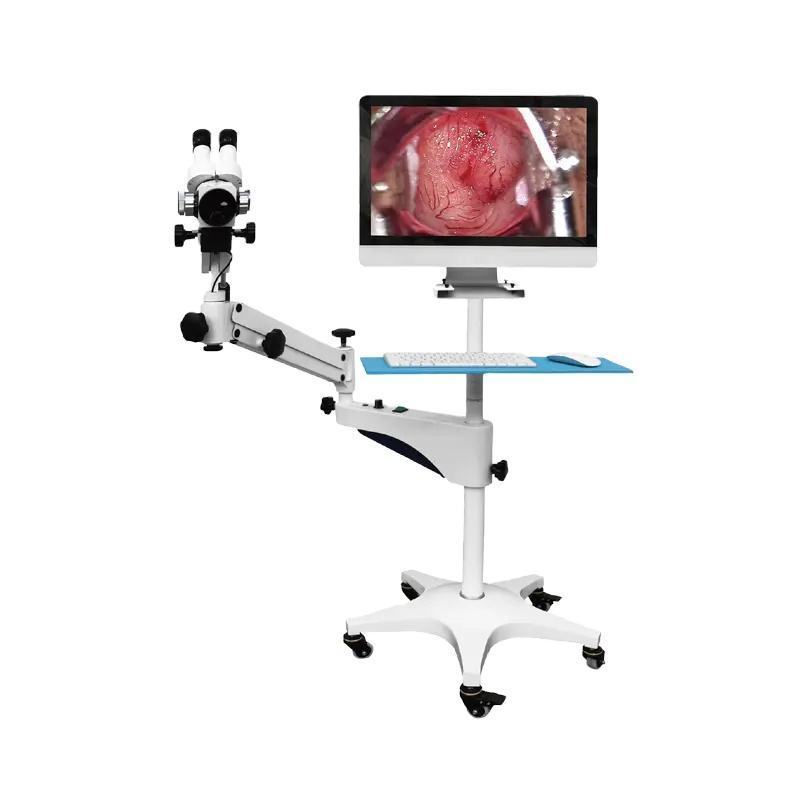 Colposcopy vagina digital electronic Video Colposcope camera for medical device edan colposcopy for gynecology