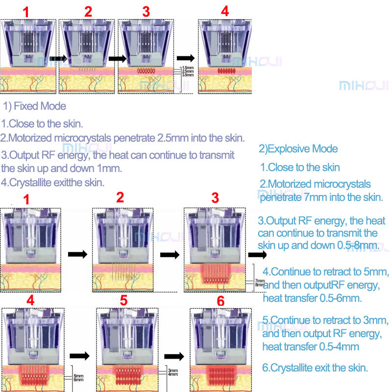 vertical morpheus 8 fractional machine  body face microneedling rf fractional machine