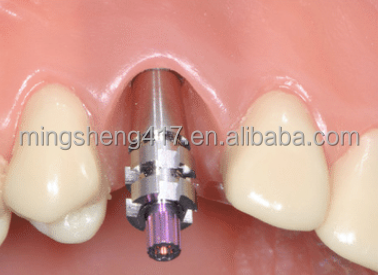 Dental implant transfer model impression transfer ITI coping  zimmer open closed transfer osstem dentium system