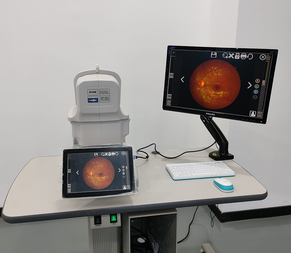 High End Eye Fluorescence Angiography Machine Non-mydriatic Digital Automatic Fundus Camera For Ophthalmic