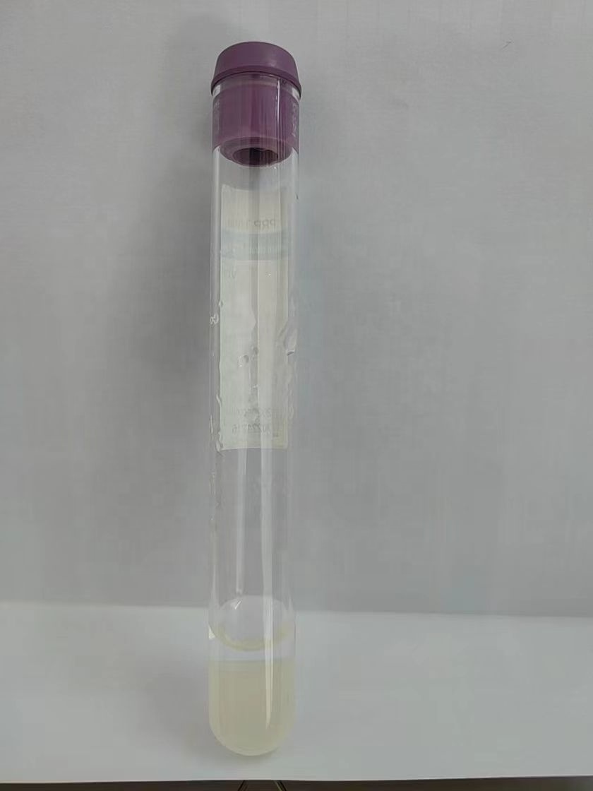 Factory Price Medical PRP kit machine 10ml PRP tube anticoagulant gel blood test tube PRP kit