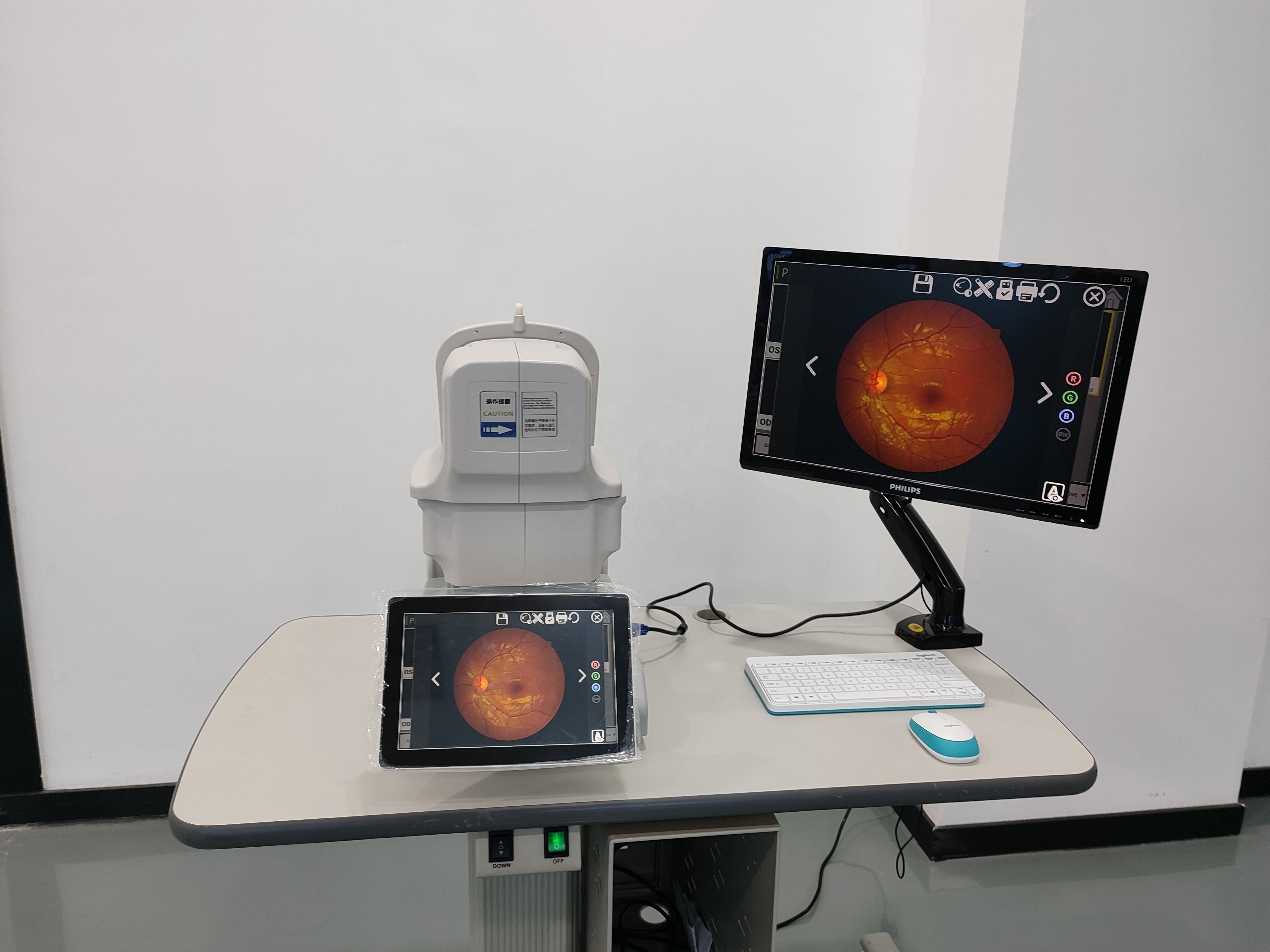 Ophthalmic Devices Digital Automatic Eye Examination Camera Auto Digital Non-mydriatic Retinal Eye Fundus Camera