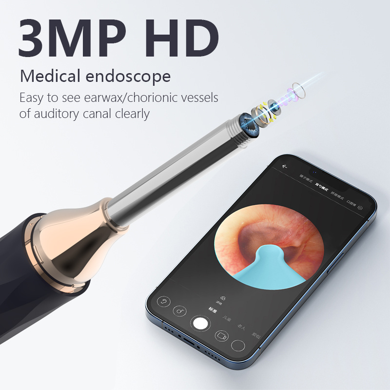 Visible Earwax Cleaner Smart Ear Pick with HD Camera Light Otoscope WiFi APP Connect Ear Wax Removal Kits for Ears Cleaning