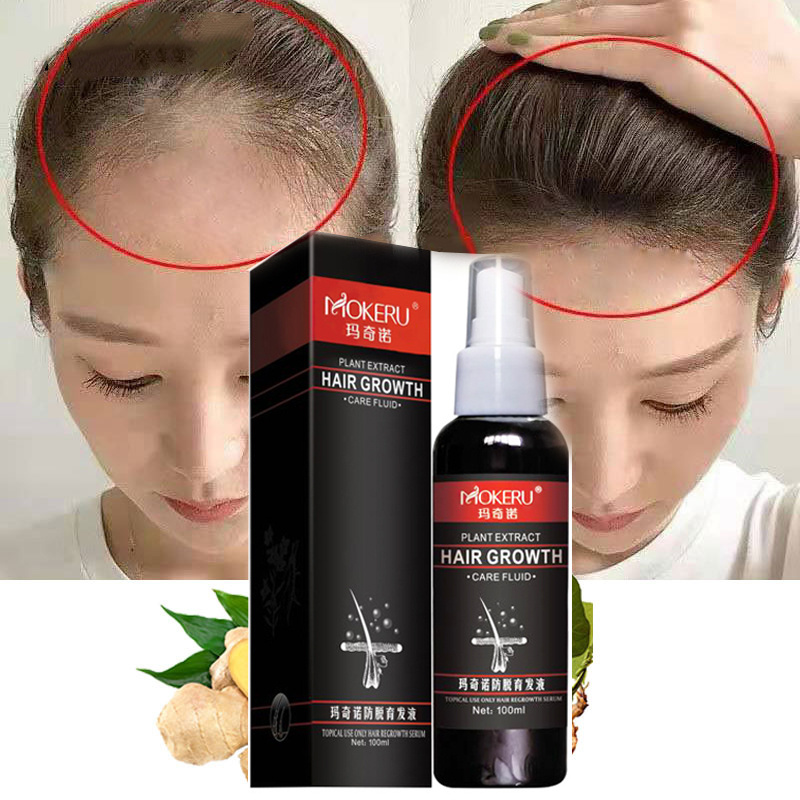 MOKERU Fast Hair Growth Lotion Oil Prevent Hair Loss Treatment Ginger Extract Growing Hair Products for Baldness Treatment