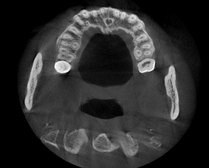 Dental Equipment Panorama Xray Rayos X Periapical Cephalometric X Ray Machine Digital OPG Panoramic 3D CBCT Dental X-ray