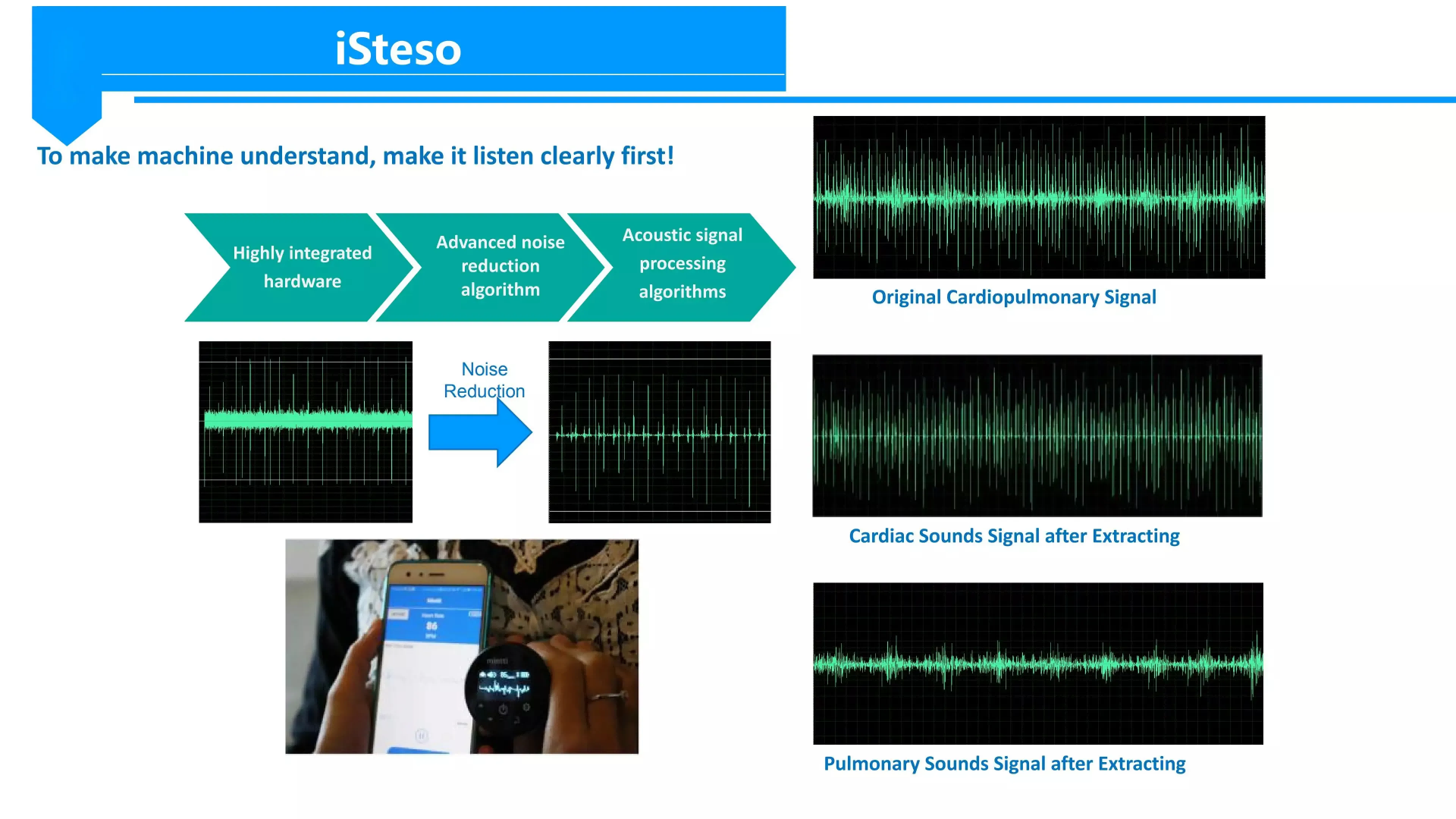 smart stethoscope smart digital stethoscope to smart stethoscope with bluetooth