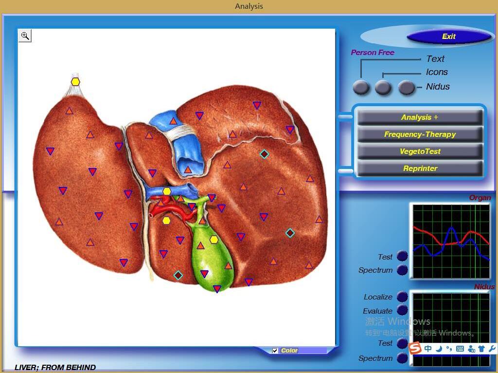 Original Software Bioresonance Quantum Magnetic Analysis Device Human  3d nls Full Body Health Analyzer Machine