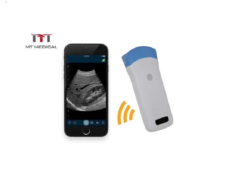 MT MEDICAL Portable Wireless Ultrasound Scanner 128 Elements Handheld High Frequency Convex Wireless Ultrasound Probe