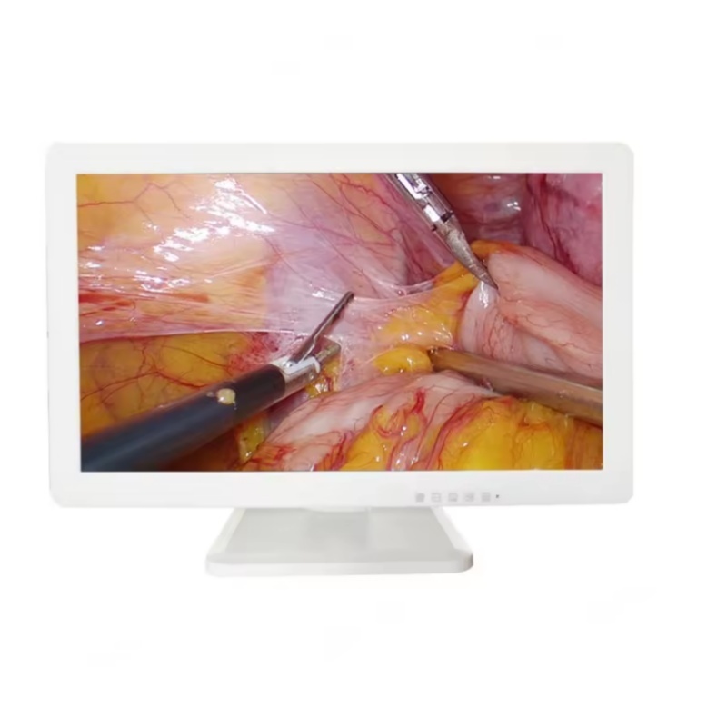 laparoscope 4k 32 inch endoscopic monitor for medical image display