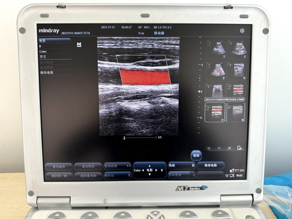 Two transducer probes Good condition used Mindray M7 Ultrasound