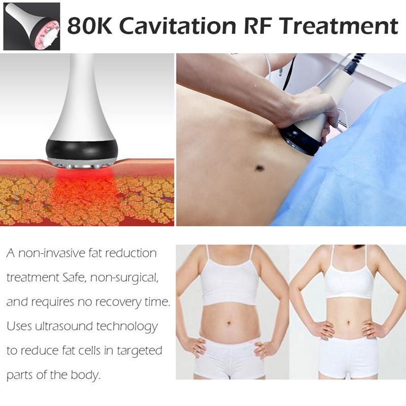 9 IN 1 40K Cavitation Cavitation Vacuum System Machine Radio Frequency Laser 8 Pads Lipo Slimming Machine