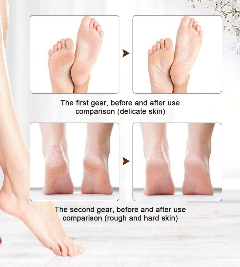 Rechargeable pedicure machine   foot callus remover  foot  callus remover foot file hard skin remover