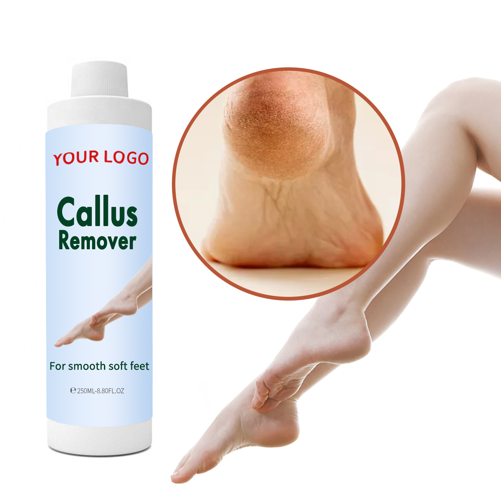 Callus Remover Feet Exfoliator Gel To Remove Calluses Dead Skin Heel Softener Pedicure Scrubber For Dry Cracked Heels