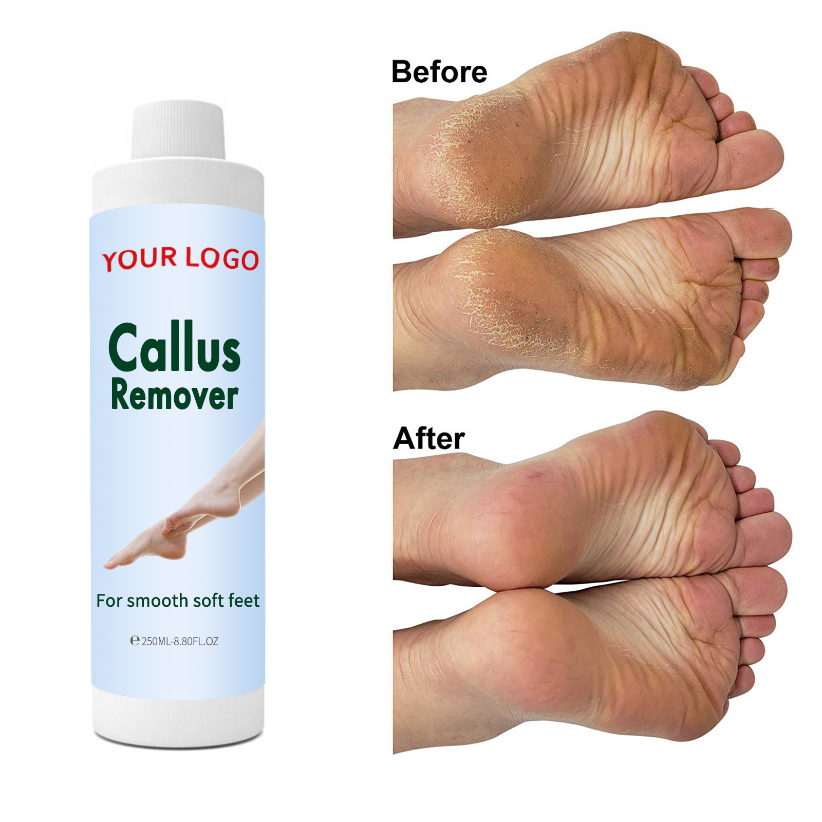 Callus Remover Feet Exfoliator Gel To Remove Calluses Dead Skin Heel Softener Pedicure Scrubber For Dry Cracked Heels