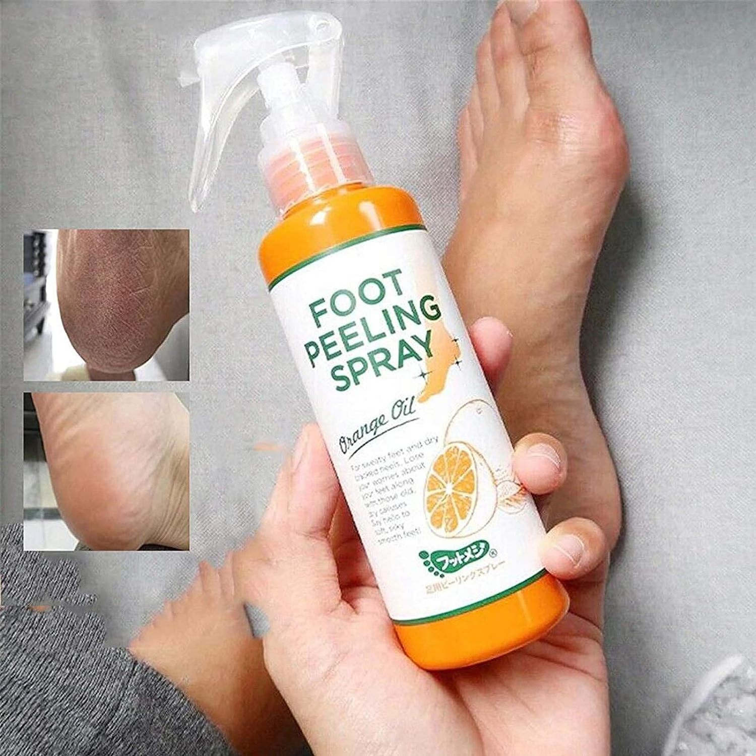 Instant Foot Peeling Spray Orange Oil Antifungal Foot Peeling Spray That Remove Dead Skin