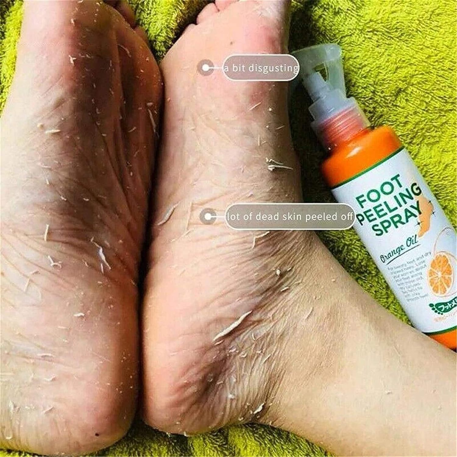 Instant Foot Peeling Spray Orange Oil Antifungal Foot Peeling Spray That Remove Dead Skin