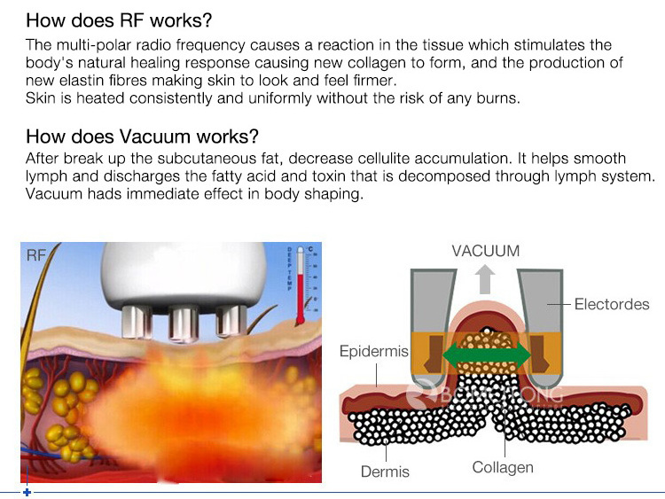 Better slim Result 5D lipo burning 80k cavi Slimming Machine For Body Slimming And 40k Fat Reduction