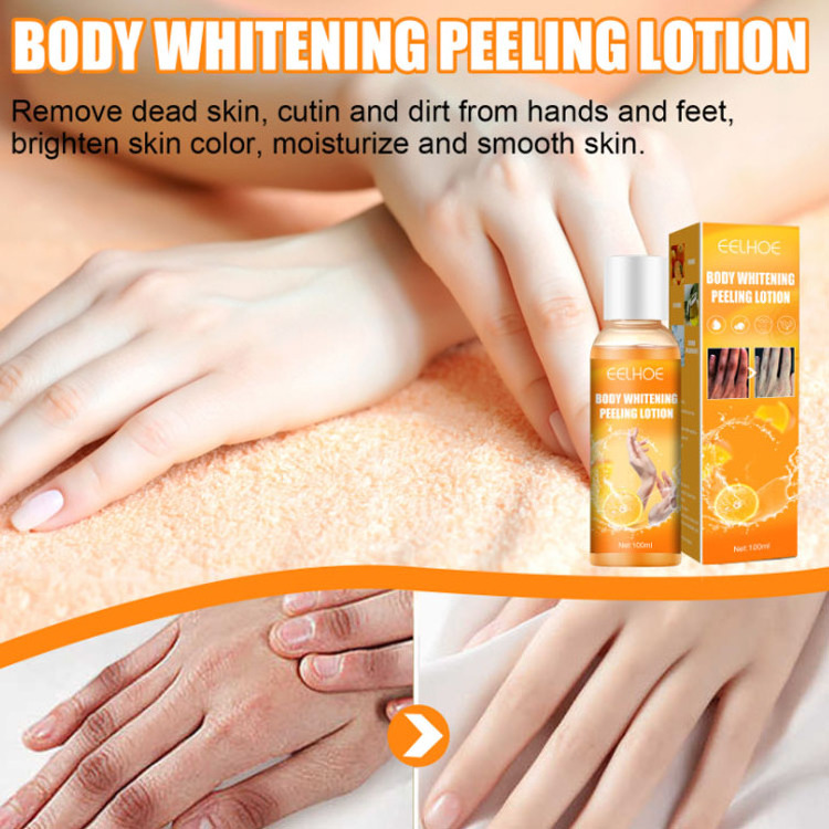 High Quality Vitamin C Body Whitening Peeling Lotion Serum Remove Dead Skin Knee Armpit Legs Whitening Moisturizer Cream