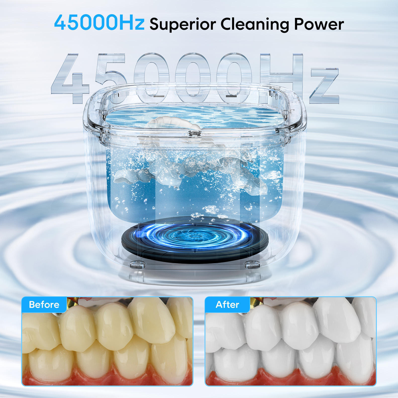 Wholesale Ultrasonic Cleaner Retainer Machine For Denture UV Ultrasonic Jewelry Cleaner for Ring Diamond