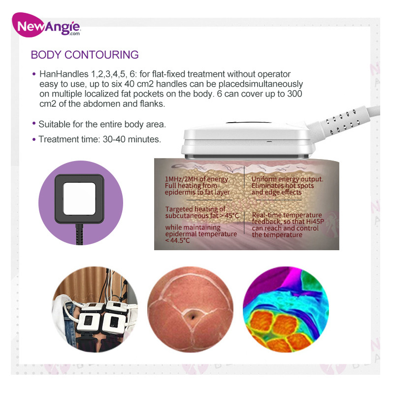 Newangie Trusculpt Butt Lift Body Sculpting  Machine Skin Tightening Fat Loss Machine Trufat RF Body Shaping Muscle Machine