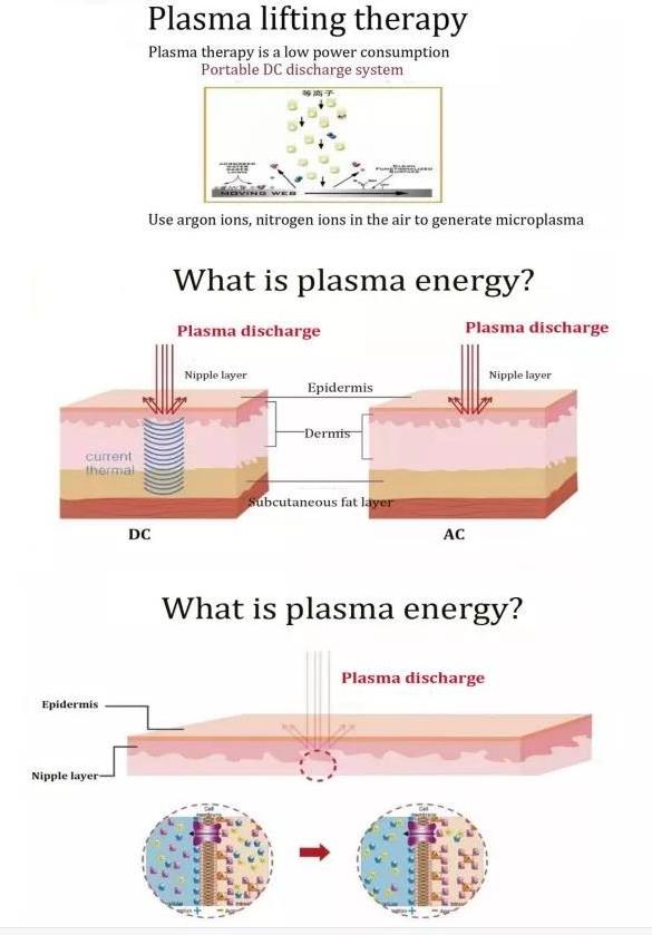 Plasma Pen Jet Plasma Lifting Eyelid Lifting Machine Wrinkle Removal Skin Rejuvenation Acne Remover Plasma machine w