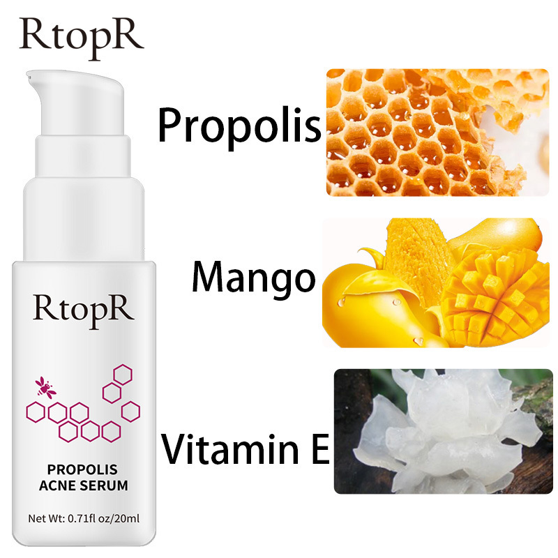 RtopR Official Store Propolis Acne Serum Repair Acne Brightening Serum Scar Spots Cleaning Serum Shrink Pores Acne Treatment