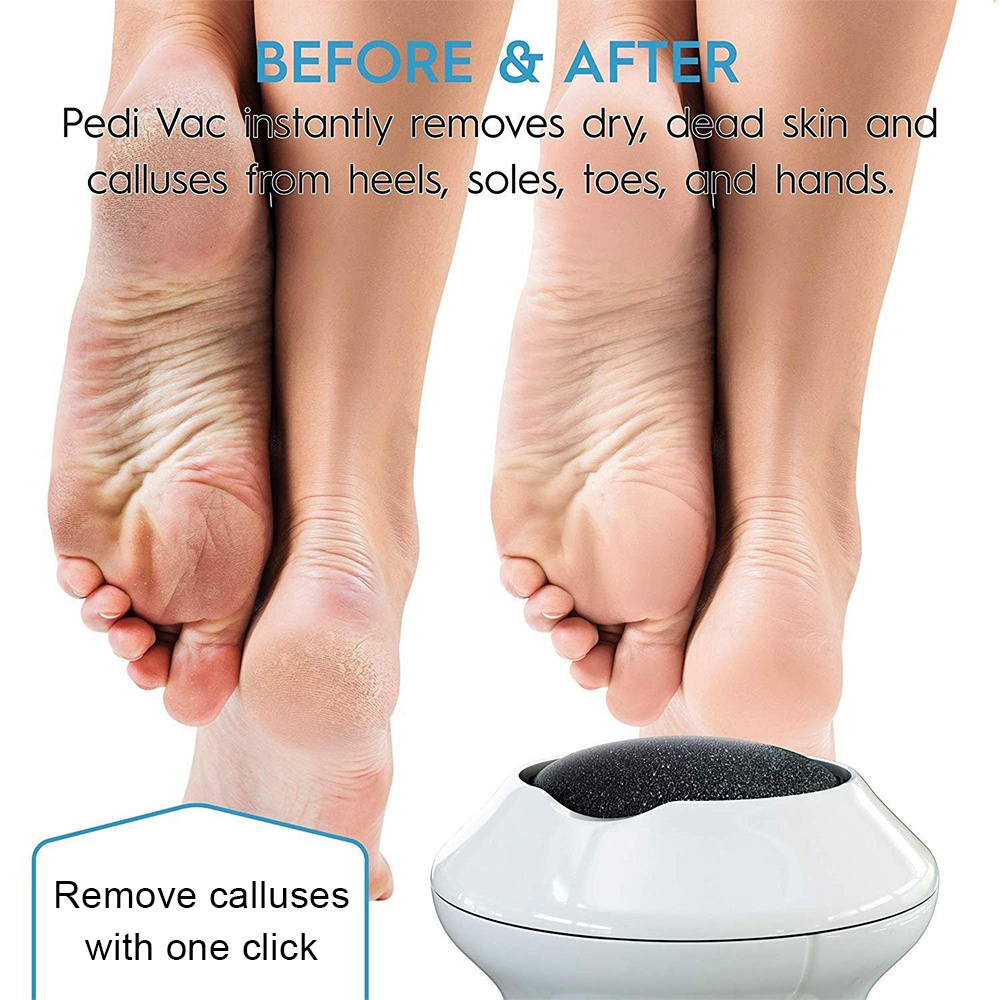 2023 Professional Portable USB Electric Callus Remover Exfoliate Shaver Deep Clean Foot File Dead Skin Remover