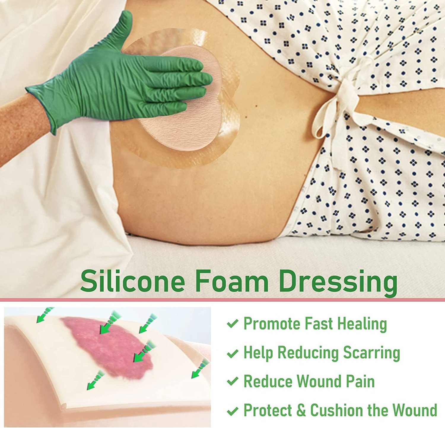 Silicone - Sacral Bordered Silicone Adhesive Foam Wound Dressing, Bed Sore Treatment Bandage for Sacrum